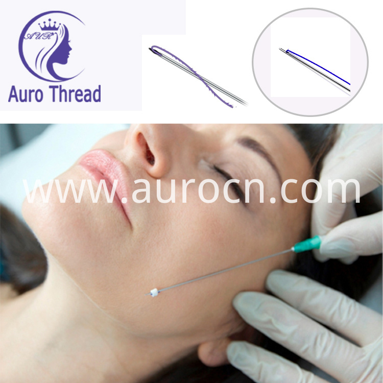 pdo thead face lift pdo thead face lift